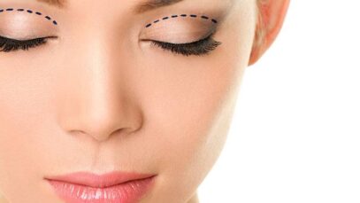 Así es la blefaroplastia, la cirugía que devuelve la naturalidad a tu mirada
