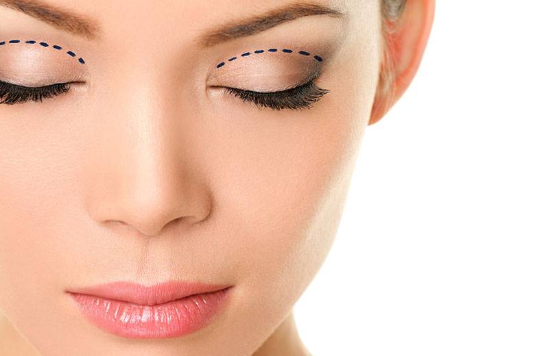 Así es la blefaroplastia, la cirugía que devuelve la naturalidad a tu mirada
