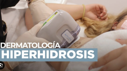 Elimina el sudor de tus axilas de forma permanente con Miradry