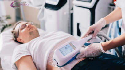Reducción de grasa – CoolSculpting: todo lo que necesitas saber