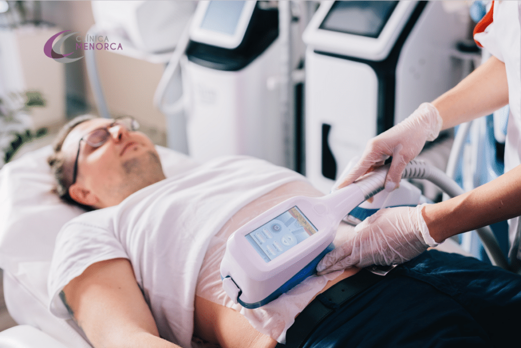 Reducción de grasa – CoolSculpting: todo lo que necesitas saber